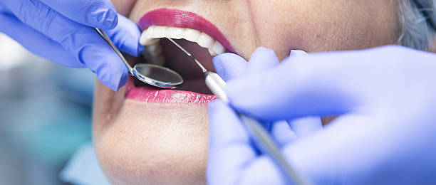 Best Emergency Tooth Extraction in Dayton, NJ